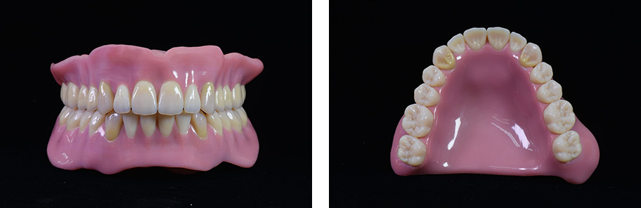 Figure 2. Items formed (batch formation of dentures)